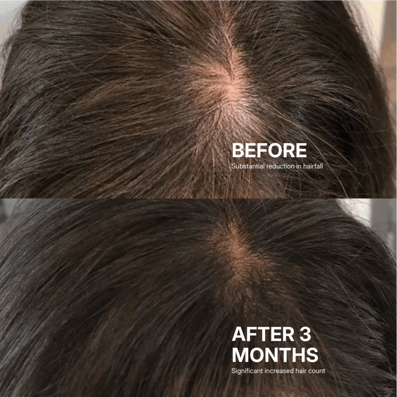 Growsemary Shampoo + Conditioner - STOP HAIR LOSS